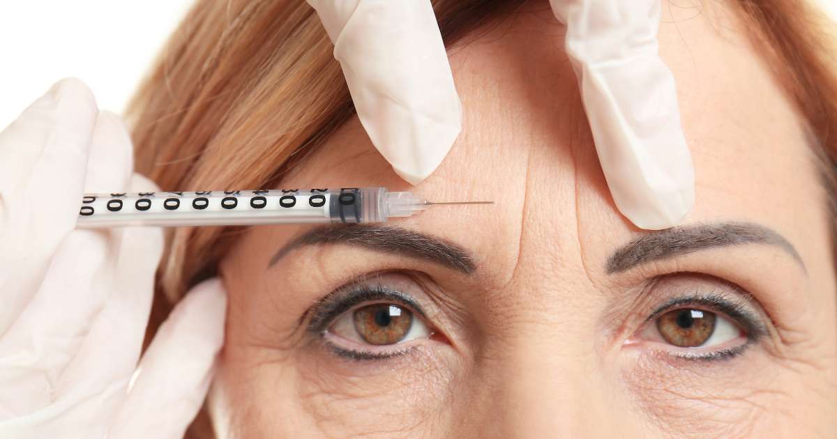 tratamiento de toxina botulinica o botox