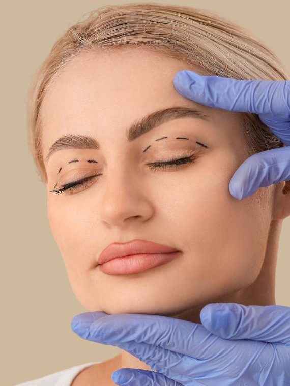 cirugia-parpado-superior-alcobendas